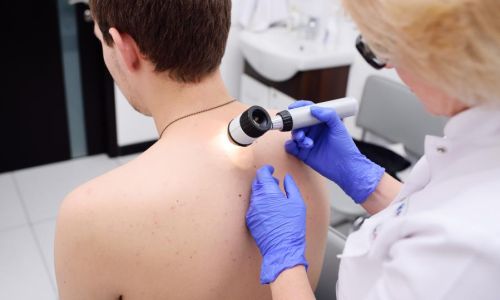 Visita dermatologo per macchie pelle pitiriasi e dermatosi