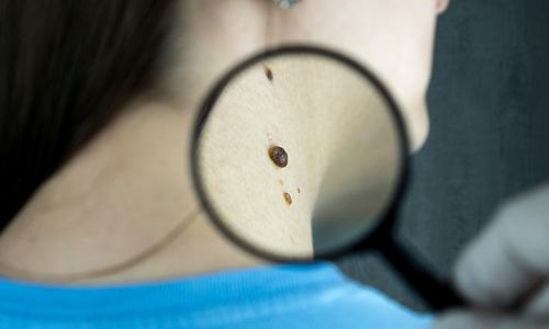 Origini e sviluppo del dermatologo nella storia