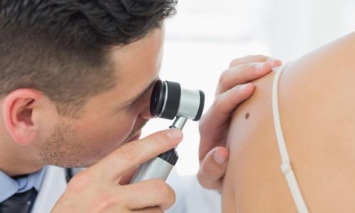 Controllo dermatologico per diagnosi basalioma o melanoma a Milano