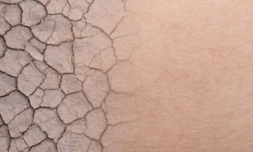 come posso affrontare la pelle disidratata?