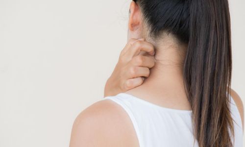 Riconoscere e curare l'intertrigine a Milano