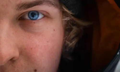 consigli autunnali per la cura della pelle