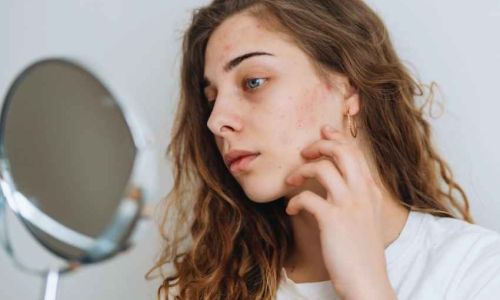 correlazione tra psicologia e patologie dermatologiche