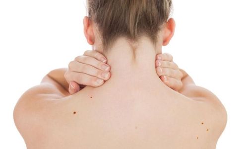 Quando controllare i nei: mappatura digitale dal dermatologo